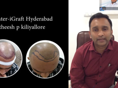 iGraft Hyderabad Reviews by Mr Pratheesh