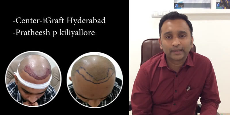 iGraft Hyderabad Reviews by Mr Pratheesh