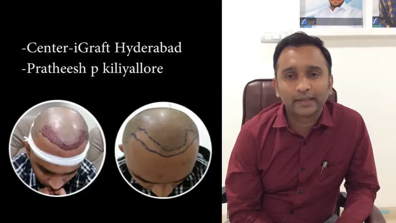 iGraft Hyderabad Reviews by Mr Pratheesh