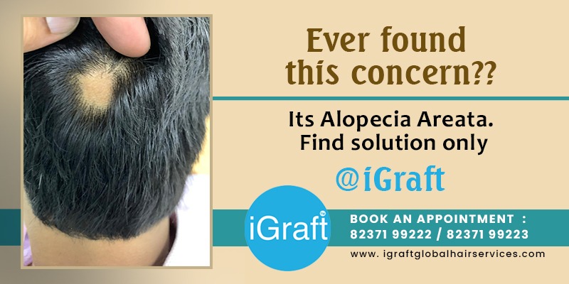 Hair Transplant|Laser Hair Reduction,Removal in India|Pune|Hyderabad| Bangalore|Vijayawada Hair Transplant|Laser Hair Reduction,Removal in India|Pune|Hyderabad| Bangalore|Vijayawada