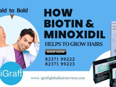 How BioTin & Minoxidil helps growing here