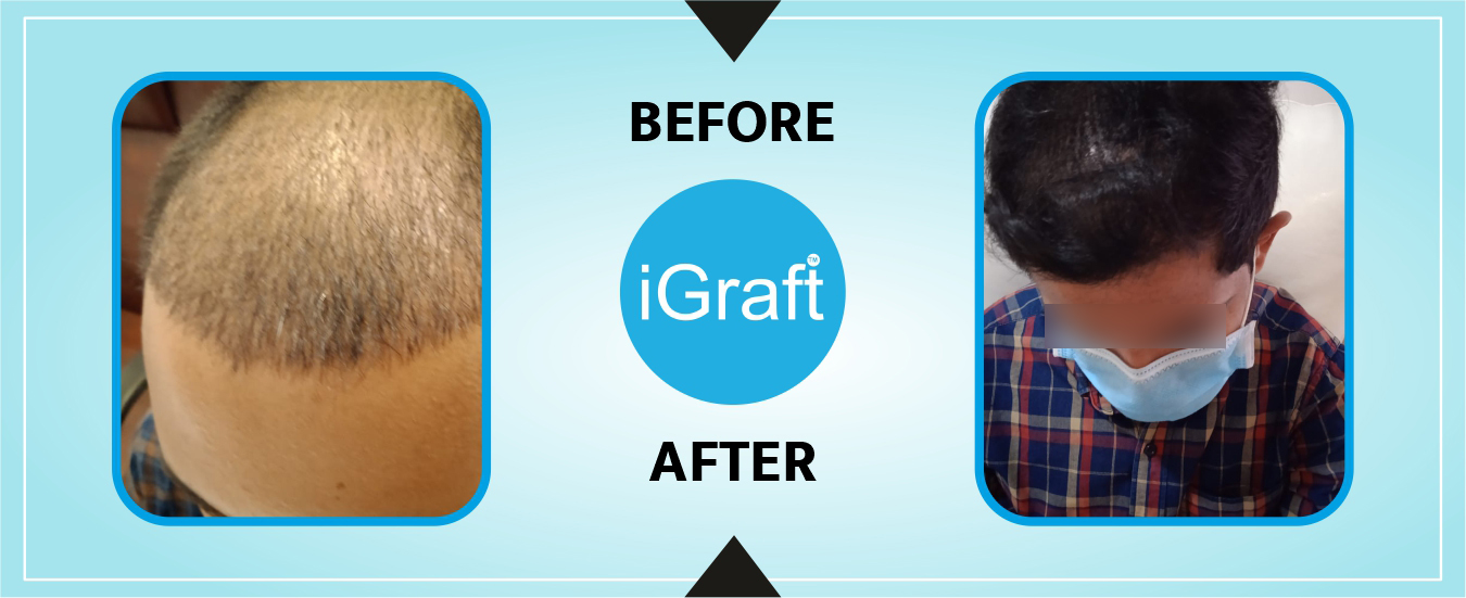 Igraft Pune Reviews 