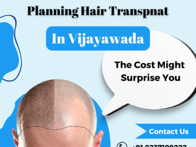 Hair Transplant in Vijayawada