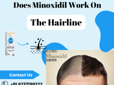 Minoxidil