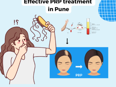 effective PRP treatment