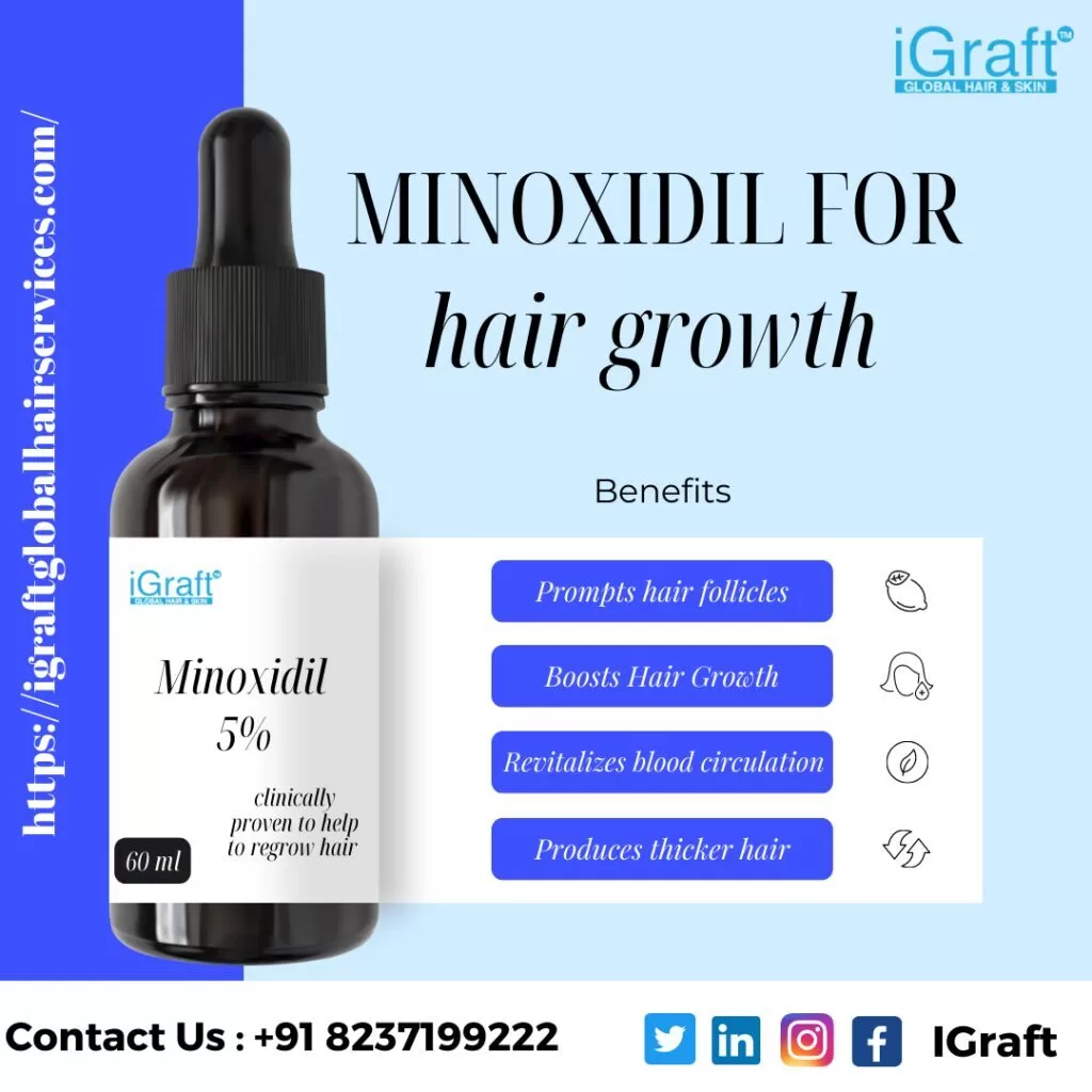 Minoxidil For hair growth
