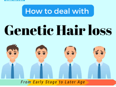 Genetic hair loss treatment