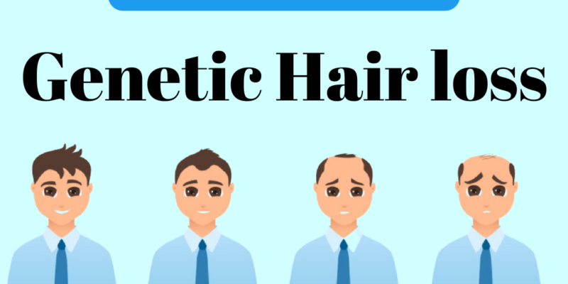 Genetic hair loss treatment