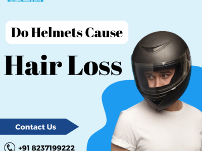 do Helmet causes hair loss