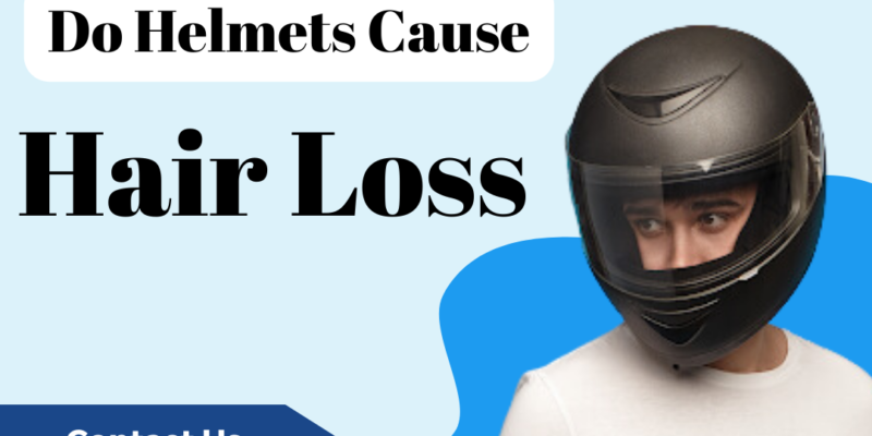 do Helmet causes hair loss
