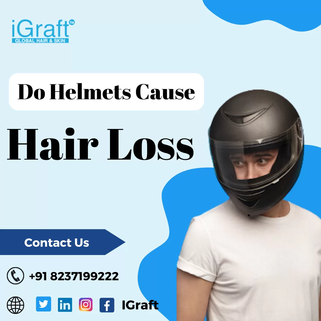 do Helmet causes hair loss