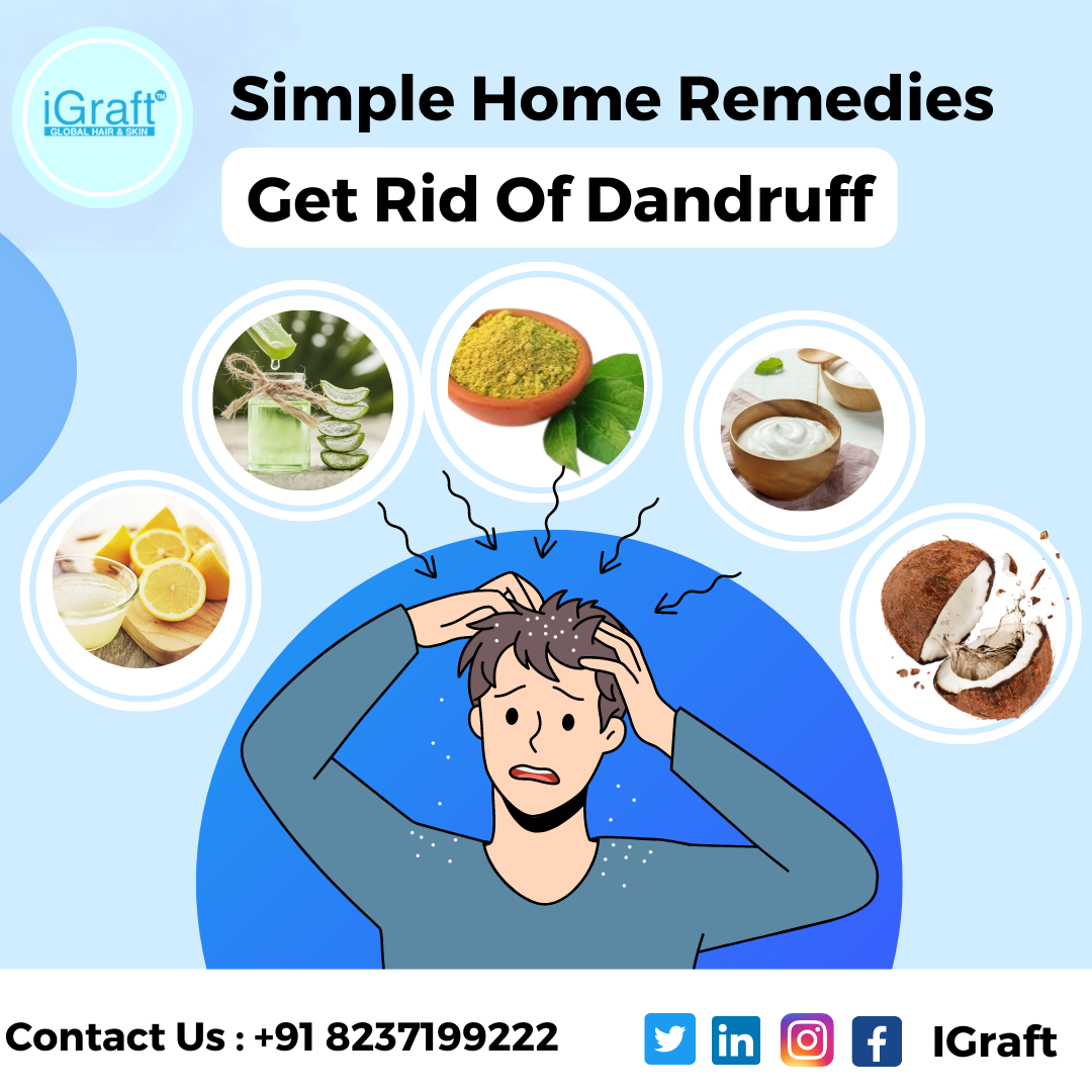 Best solution for dandruff hotsell