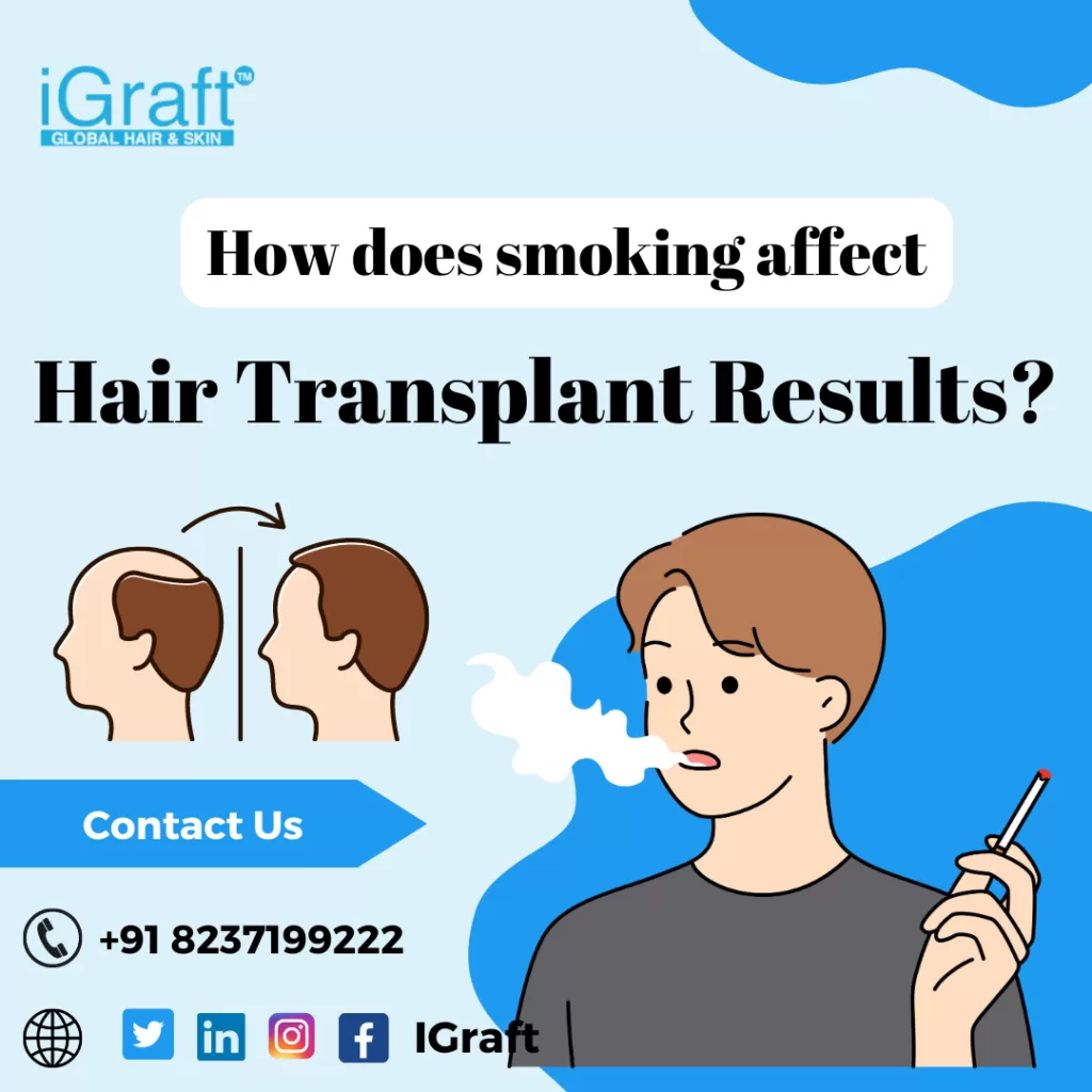 smoking affecting hair loss