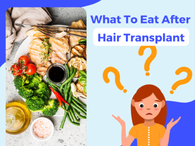 what to eat after hair transplant