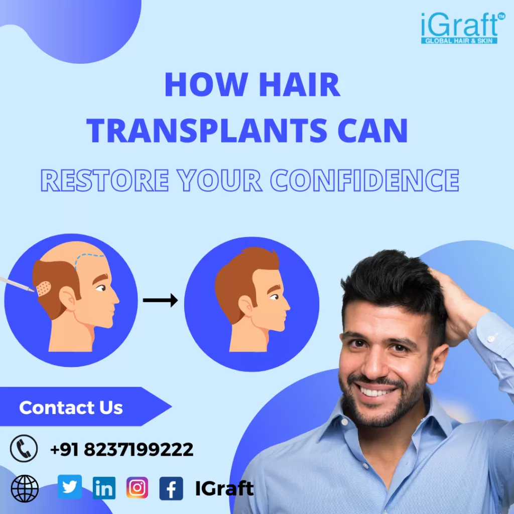 iGraft Pune