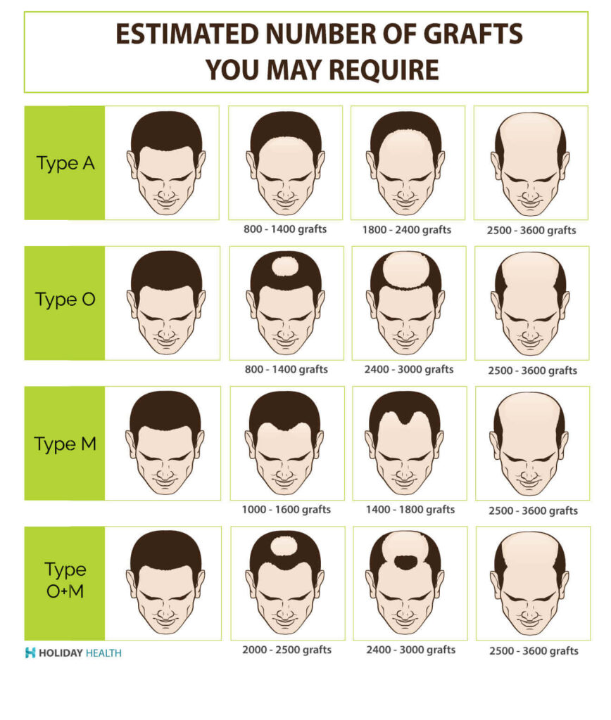 Best Hair Transplant Cost In Pune India