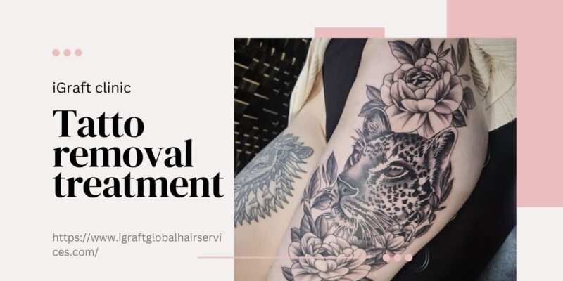 Tattoo Removal Treatment