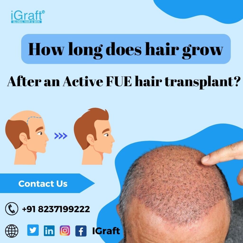 FUE hair transplant