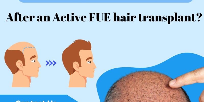 FUE hair transplant