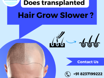does transplanted hair grow slower