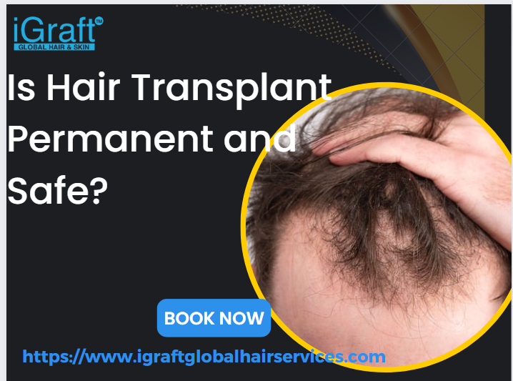  Is Hair Transplant Permanent and Safe? 