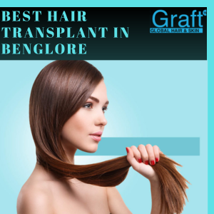 Best Hair Transplant in Benglore