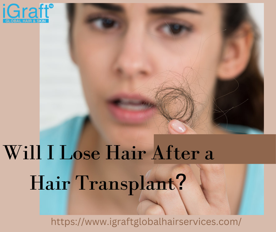 Will I Lose Hair After a Hair Transplant?