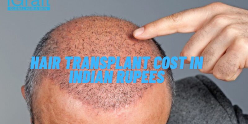 Hair Transplant Cost in Indian Rupees