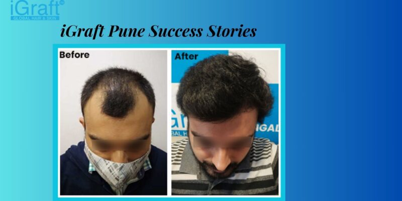 iGraft Pune Success Stories