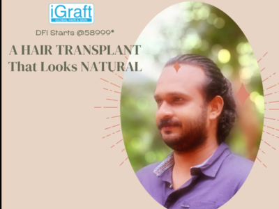 iGraft Hair Transplant Review