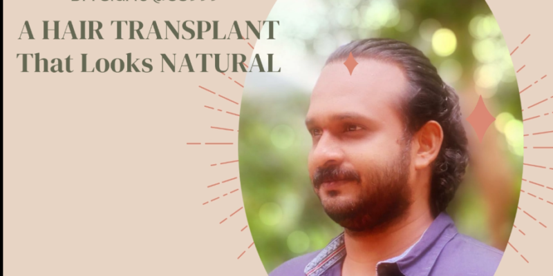 iGraft Hair Transplant Review