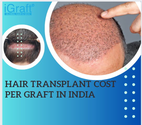 Hair Transplant Cost Per Graft in India