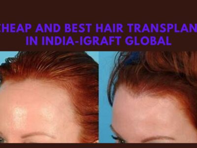 Cheap and Best Hair Transplant in India