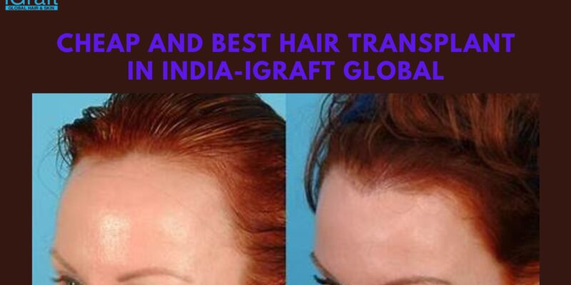 Cheap and Best Hair Transplant in India