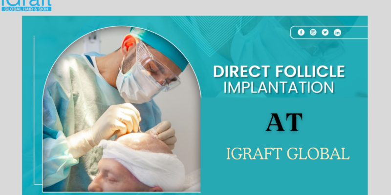 Direct Follicle Implant Technique (DFI)