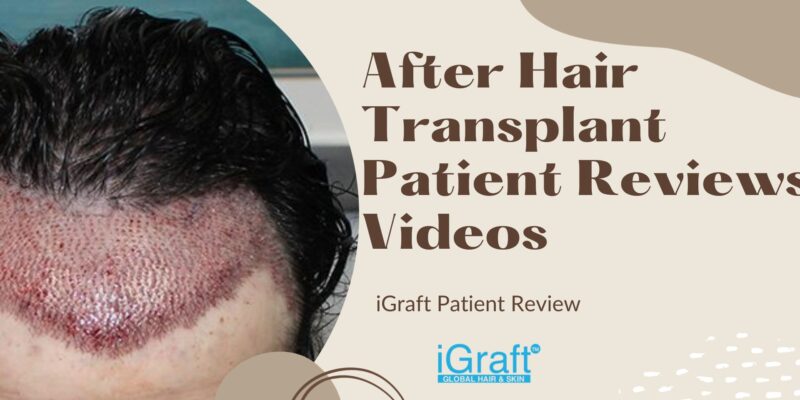 iGraft Patient Review