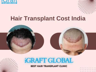 Hair Transplant Cost India