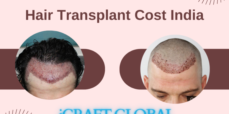 Hair Transplant Cost India