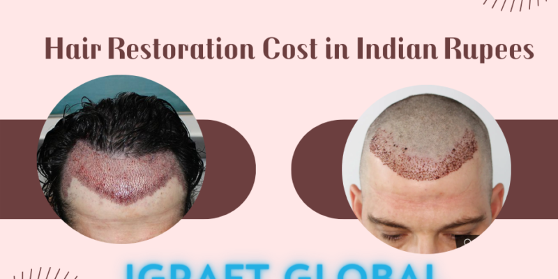 Hair Restoration Cost in Indian Rupees