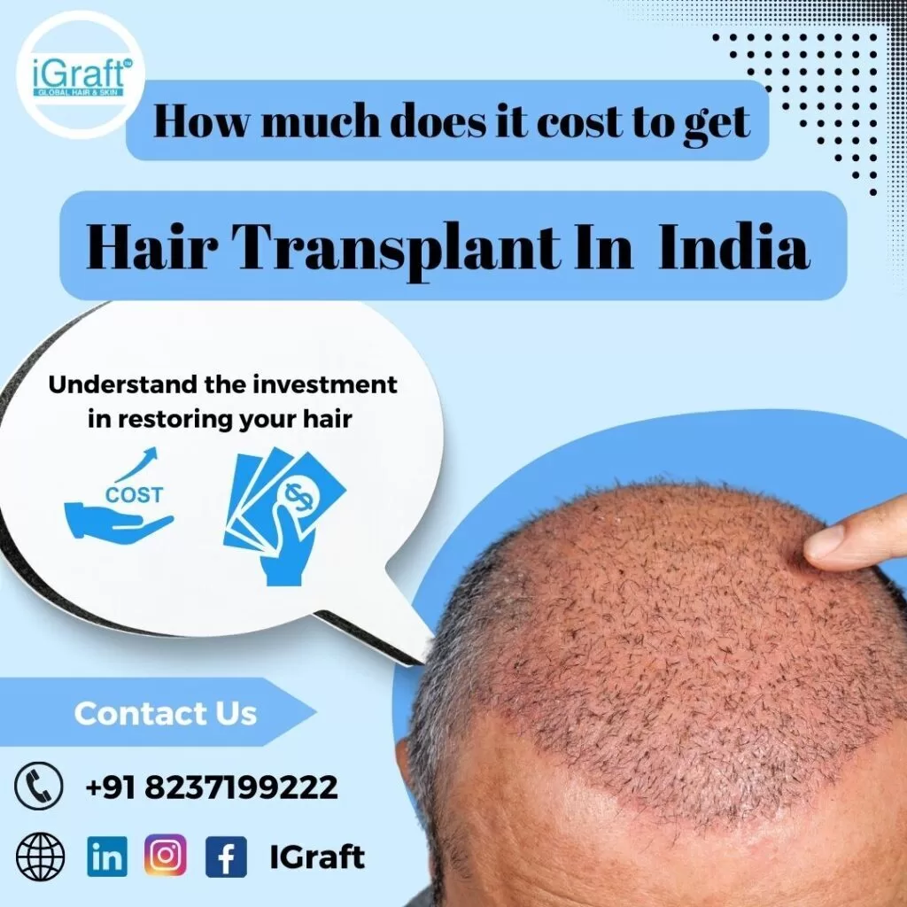 Hair Transplant In India