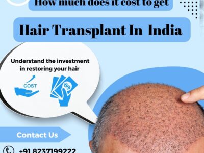 Hair Transplant In India