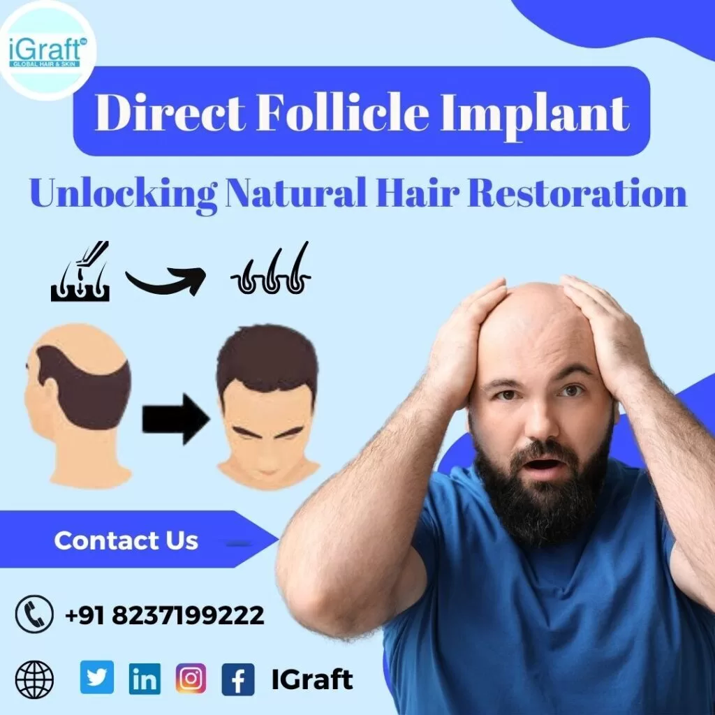 Direct Follicle Implant- DFI