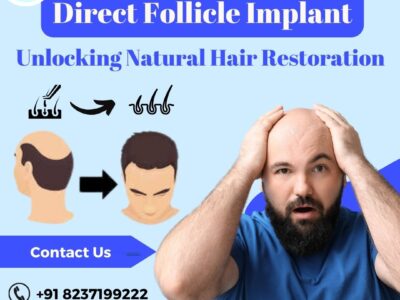 Direct Follicle Implant- DFI