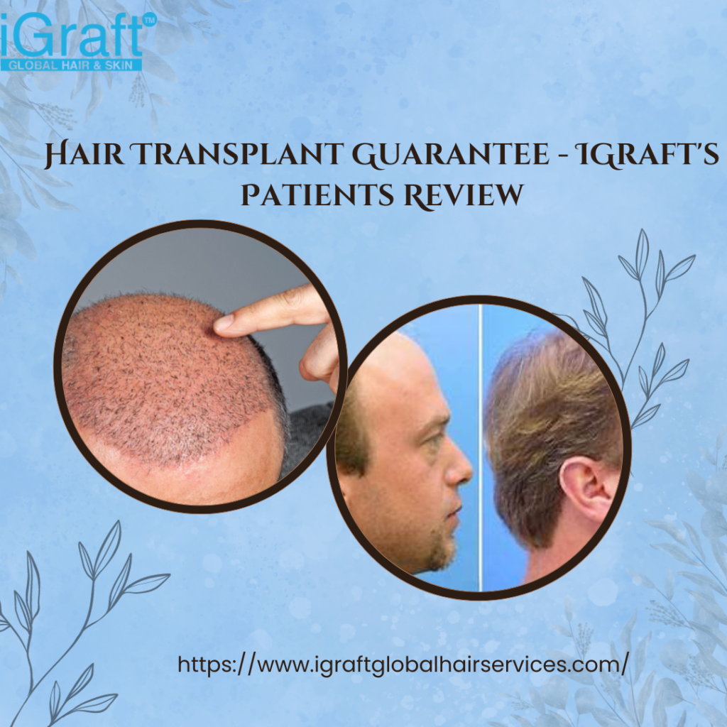 Hair Transplant Guarantee - IGraft's Patients Review