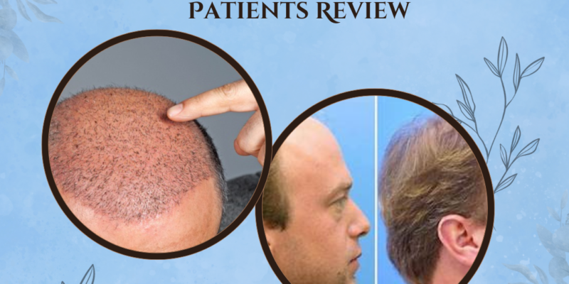 Hair Transplant Guarantee - IGraft's Patients Review