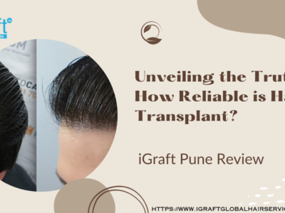 Best iGraft Pune Review