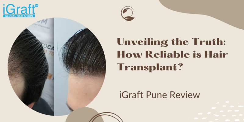 Best iGraft Pune Review