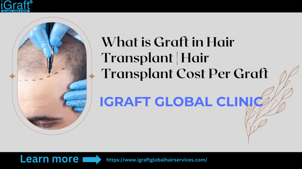 Hair Transplant Cost Per Graft Overview