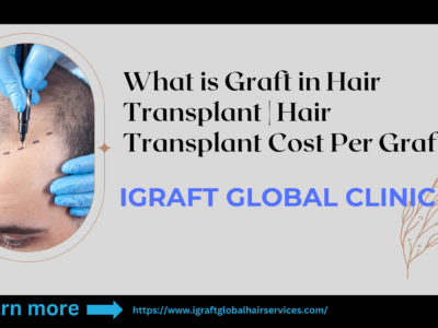 Hair Transplant Cost Per Graft Overview