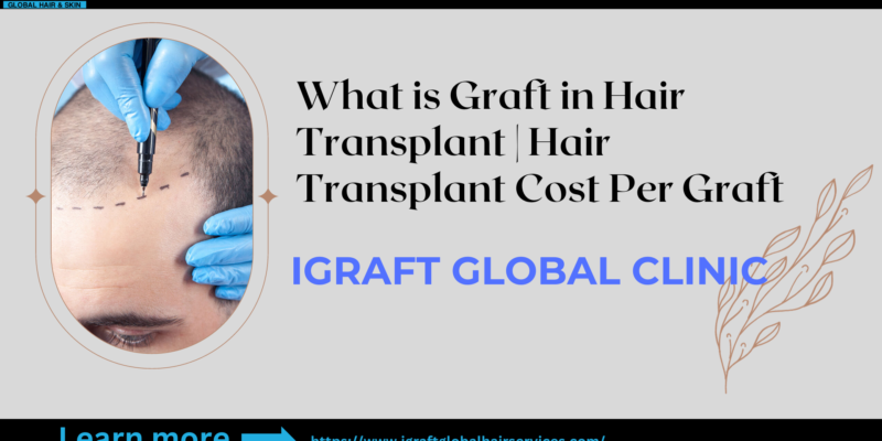 Hair Transplant Cost Per Graft Overview
